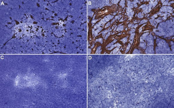 Anti-Reticular fibroblasts Antibody, clone ER-TR7