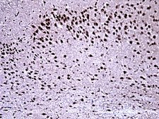 Anti-Ataxin-1 Antibody, 11NQ, clone N76/8 clone N76/8, from mouse