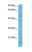 Anti-ND6 affinity isolated antibody