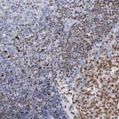 Anti-IRF8 antibody produced in rabbit Prestige Antibodies® Powered by Atlas Antibodies, affinity isolated antibody, buffered aqueous glycerol solution