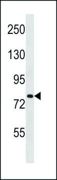 ANTI-SLC24A3 (N-TERM) antibody produced in rabbit IgG fraction of antiserum, buffered aqueous solution