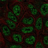 Anti-ESRP1 antibody produced in rabbit Prestige Antibodies® Powered by Atlas Antibodies, affinity isolated antibody, buffered aqueous glycerol solution, Ab2