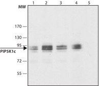 Anti-PIP5K1C (C-terminal) antibody produced in rabbit ~1.5 mg/mL, affinity isolated antibody, buffered aqueous solution