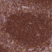 Anti-SIPA1 antibody produced in rabbit Prestige Antibodies® Powered by Atlas Antibodies, affinity isolated antibody, buffered aqueous glycerol solution