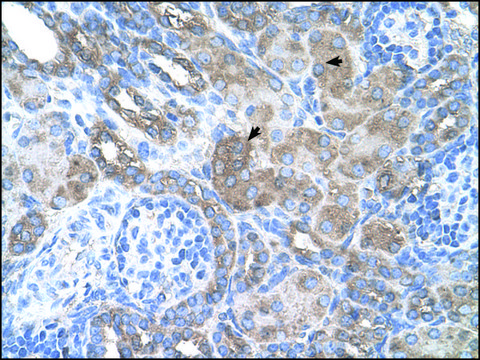 Anti-SILV antibody produced in rabbit IgG fraction of antiserum