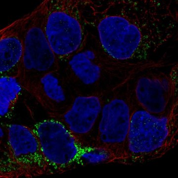 Anti-CLN6 antibody produced in rabbit Prestige Antibodies&#174; Powered by Atlas Antibodies, affinity isolated antibody