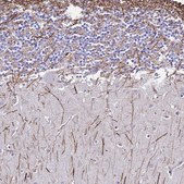 Anti-DLX1 antibody produced in rabbit Prestige Antibodies® Powered by Atlas Antibodies, affinity isolated antibody, buffered aqueous glycerol solution