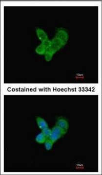 Anti-C9 antibody produced in rabbit affinity isolated antibody, buffered aqueous solution