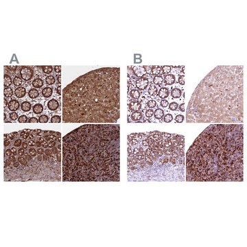 Anti-BLVRB antibody produced in rabbit Prestige Antibodies&#174; Powered by Atlas Antibodies, affinity isolated antibody, buffered aqueous glycerol solution