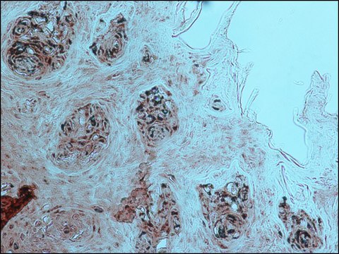 Anti-Endothelial Cells antibody, Mouse monoclonal clone P1H12, purified from hybridoma cell culture