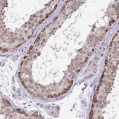 Anti-RIOK1 antibody produced in rabbit Prestige Antibodies® Powered by Atlas Antibodies, affinity isolated antibody, buffered aqueous glycerol solution