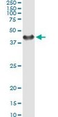 Monoclonal Anti-SGTA antibody produced in mouse clone 2E11, purified immunoglobulin, buffered aqueous solution