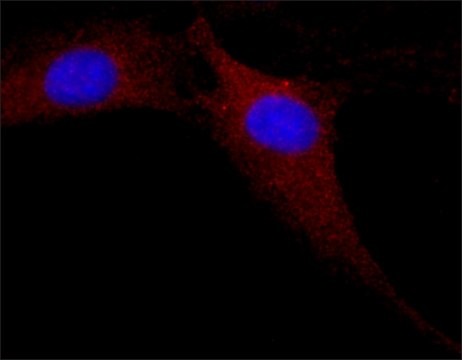 Anti-MAP Kinase, Activated (Diphosphorylated ERK-1&amp;2) antibody, Mouse monoclonal clone MAPK-YT, purified from hybridoma cell culture