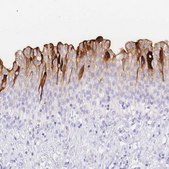 Anti-UPK1A antibody produced in rabbit Prestige Antibodies® Powered by Atlas Antibodies, affinity isolated antibody, buffered aqueous glycerol solution