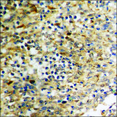 Anti-phospho-AKT1 (pThr308) antibody produced in rabbit affinity isolated antibody