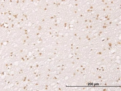 Monoclonal Anti-MDM2 antibody produced in mouse clone 1A7, purified immunoglobulin, buffered aqueous solution