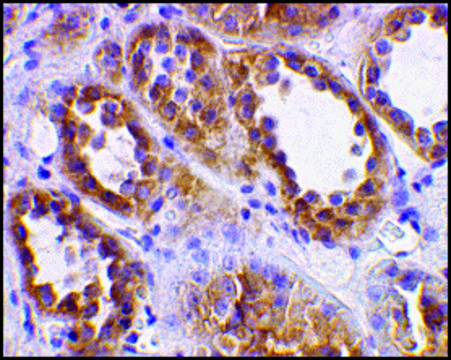 抗-ACE2 兔抗 affinity isolated antibody