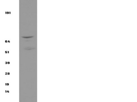 抗-IKK&#946;抗体，克隆10AG2 clone 10AG2, Upstate&#174;, from mouse