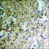 Anti-phospho-CRYAB (pSer19) antibody produced in rabbit affinity isolated antibody