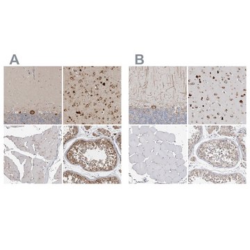 Anti-ATXN2 antibody produced in rabbit affinity isolated antibody, buffered aqueous glycerol solution, Ab3