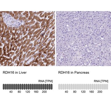 Anti-RDH16 antibody produced in rabbit Prestige Antibodies&#174; Powered by Atlas Antibodies, affinity isolated antibody, buffered aqueous glycerol solution