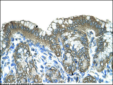 Anti-RARRES3 antibody produced in rabbit IgG fraction of antiserum