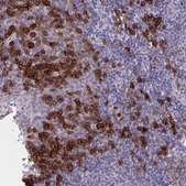Anti-SLAMF7 antibody produced in rabbit Prestige Antibodies® Powered by Atlas Antibodies, affinity isolated antibody, buffered aqueous glycerol solution
