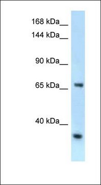 Anti-RBM15B antibody produced in rabbit affinity isolated antibody