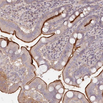 Anti-TCHP antibody produced in rabbit affinity isolated antibody, buffered aqueous glycerol solution