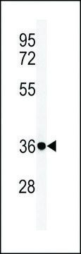 ANTI-FCGR1A (CENTER) antibody produced in rabbit affinity isolated antibody, buffered aqueous solution