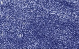 Anti-VCAM-1 Antibody, clone 5K19 ZooMAb® Rabbit Monoclonal recombinant, expressed in HEK 293 cells