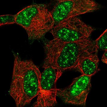 Anti-CYGB antibody produced in rabbit Prestige Antibodies&#174; Powered by Atlas Antibodies, affinity isolated antibody