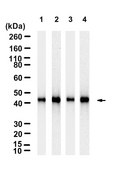 Anti-α Actin 2 Antibody, clone 1C22 ZooMAb® Rabbit Monoclonal recombinant, expressed in HEK 293 cells