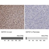 Anti-GSTO1 antibody produced in rabbit Prestige Antibodies® Powered by Atlas Antibodies, affinity isolated antibody, buffered aqueous glycerol solution