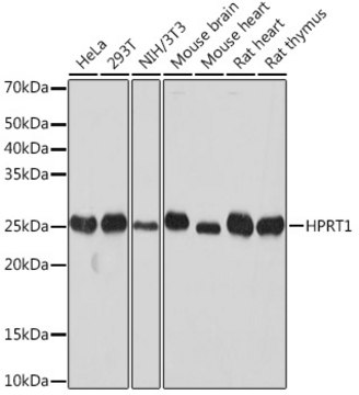 [KO Validated]Anti-HPRT1 Antibody, clone 4N2Q6, Rabbit Monoclonal