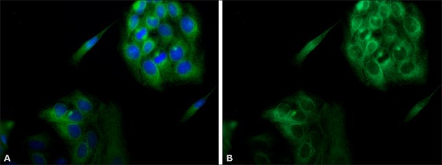 抗钙联蛋白 兔抗 IgG fraction of antiserum, buffered aqueous solution