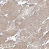 Anti-KIAA0556 antibody produced in rabbit Prestige Antibodies® Powered by Atlas Antibodies, affinity isolated antibody, buffered aqueous glycerol solution