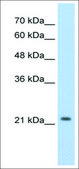 Anti-DLX2 (AB2) antibody produced in rabbit IgG fraction of antiserum