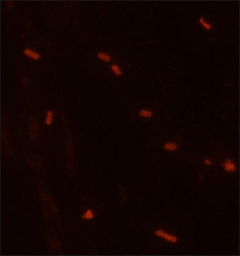 Anti-Proteus mirabilis LPS antibody, Mouse monoclonal clone PMIR174, purified from hybridoma cell culture