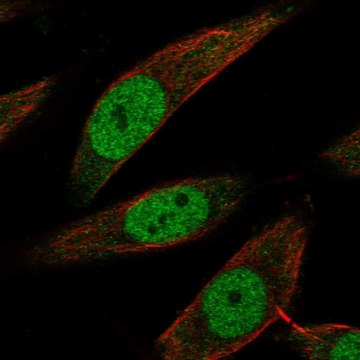 Anti-Bag1 Antibody Produced In Rabbit Prestige Antibodies&#174; Powered by Atlas Antibodies, affinity isolated antibody, buffered aqueous glycerol solution