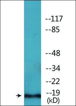 Anti-phospho-PEA-15 (pSer104) antibody produced in rabbit affinity isolated antibody