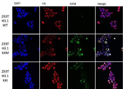 Anti-Histone H3 K4M mutant