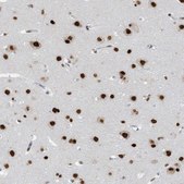 Anti-KHSRP antibody produced in rabbit Prestige Antibodies&#174; Powered by Atlas Antibodies, affinity isolated antibody, buffered aqueous glycerol solution
