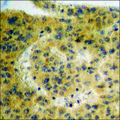 Anti-phospho-IKK-α (pSer176) /IKK-β (pSer177) antibody produced in rabbit affinity isolated antibody