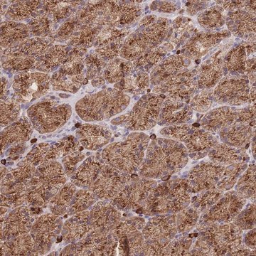 Anti-SGSM3 antibody produced in rabbit Prestige Antibodies&#174; Powered by Atlas Antibodies, affinity isolated antibody, buffered aqueous glycerol solution