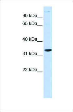 Anti-ANP32B antibody produced in rabbit affinity isolated antibody