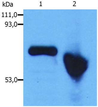 Monoclonal Anti-alphaFetoprotein antibody produced in mouse clone AFP-01