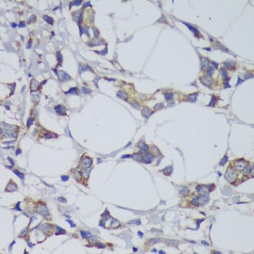 Anti-GSK3B antibody produced in rabbit