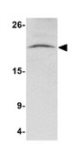 Anti-NANOS3 Antibody from rabbit, purified by affinity chromatography