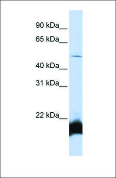 Anti-ONECUT1 (ab1) antibody produced in rabbit affinity isolated antibody